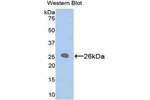 Detection of Recombinant Bcl2, Rat using Polyclonal Antibody to B-Cell Leukemia/Lymphoma 2 (Bcl2) (Bcl-2 抗体  (AA 2-208))