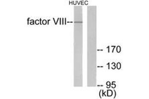 Western blot analysis of extracts from HuvEc cells, using Factor VIII Antibody. (Factor VIII 抗体  (AA 2161-2210))