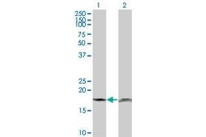 Western Blot analysis of PTH expression in transfected 293T cell line by PTH monoclonal antibody (M18), clone 3C2. (PTH 抗体  (AA 32-115))