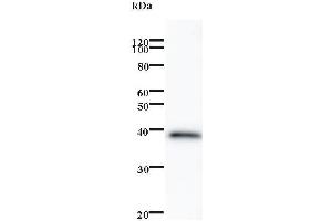 Western Blotting (WB) image for anti-Zinc finger protein ubi-d4 (DPF2) antibody (ABIN932486) (DPF2 抗体)