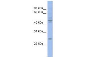 Image no. 1 for anti-PROP Paired-Like Homeobox 1 (PROP1) (C-Term) antibody (ABIN6742802) (PROP1 抗体  (C-Term))