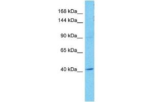 Host:  Rabbit  Target Name:  OSMR  Sample Tissue:  Human A549 Whole Cell  Antibody Dilution:  1ug/ml (Oncostatin M Receptor 抗体  (N-Term))