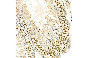 Immunohistochemistry of paraffin embedded rat testis using PCGF1 (ABIN7075123) at dilution of 1:700 (300x lens) (PCGF1 抗体)