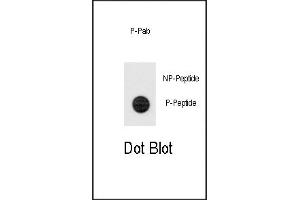 Dot blot analysis of anti-Phospho-TERT-p Antibody (ABIN389927 and ABIN2839747) on nitrocellulose membrane. (TERT 抗体  (pSer1125))