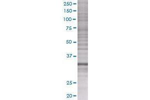 CENPH transfected lysate. (CENPH 293T Cell Transient Overexpression Lysate(Denatured))