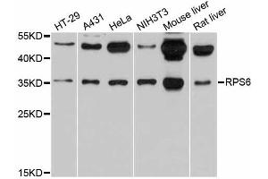 Western blot analysis of extracts of various cell lines, using RPS6 antibody (ABIN5973596) at 1/1000 dilution. (RPS6 抗体)