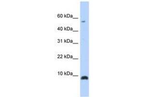 Image no. 1 for anti-Chemokine (C-X-C Motif) Ligand 6 (CXCL6) (C-Term) antibody (ABIN6740256) (CXCL6 抗体  (C-Term))