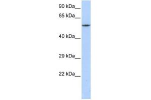 CACNB1 antibody used at 1 ug/ml to detect target protein. (CACNB1 抗体  (C-Term))