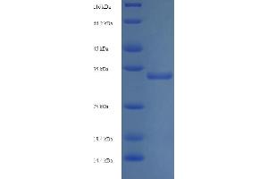 SDS-PAGE (SDS) image for Thioredoxin Domain Containing 12 (Endoplasmic Reticulum) (TXNDC12) (AA 27-172) protein (His-SUMO Tag) (ABIN5710570) (TXNDC12 Protein (AA 27-172) (His-SUMO Tag))