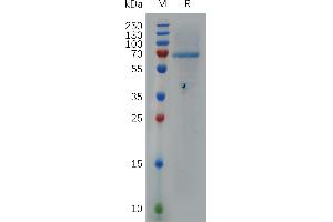 Human HPSE Protein, His Tag on SDS-PAGE under reducing condition. (HPSE Protein (AA 36-543) (His tag))
