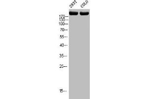 Western blot analysis of 293T COLO using p-Topo IIα (T1343) antibody. (Topoisomerase II alpha 抗体  (pSer1343))