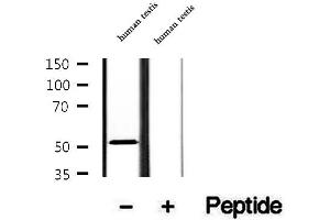 Western blot analysis of extracts of human testis tissue, using AEBP2 antibody. (AEBP2 抗体  (Internal Region))