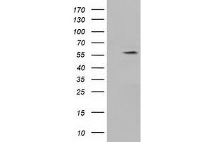 HEK293T cells were transfected with the pCMV6-ENTRY control (Left lane) or pCMV6-ENTRY KLHL2 (Right lane) cDNA for 48 hrs and lysed. (KLHL2 抗体  (AA 1-100, AA 494-593))