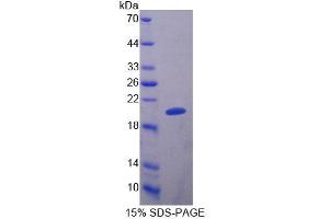 SDS-PAGE analysis of Human MRPL1 Protein. (MRPL1 蛋白)