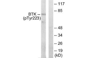 Western blot analysis of extracts from Hela cells treated with serum using BTK (phospho-Tyr223) Antibody. (BTK 抗体  (pTyr223))