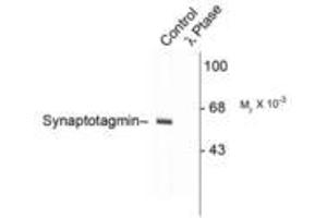 Image no. 1 for anti-Synaptotagmin I (SYT1) (pThr202) antibody (ABIN228043) (SYT1 抗体  (pThr202))