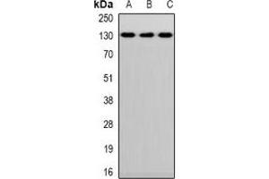Western blot analysis of CD144 expression in Hela (A), mouse lung (B), mouse heart (C) whole cell lysates. (Cadherin 5 抗体)