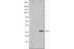 Western blot analysis of extracts of HUVEC, using HSP27 antibody. (HSP27 抗体  (N-Term))