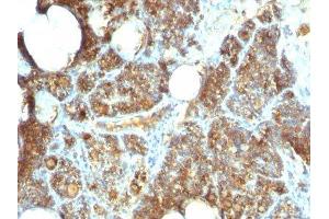 Image no. 2 for anti-Parathyroid Hormone (PTH) (C-Term) antibody (ABIN6166676) (PTH 抗体  (C-Term))