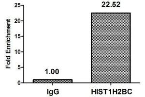 Chromatin Immunoprecipitation Hela (10 6 , treated with 30 mM sodium butyrate for 4h) were treated with Micrococcal Nuclease, sonicated, and immunoprecipitated with 5 μg anti-HIST1H2BC (ABIN7139155) or a control normal rabbit IgG. (Histone H2B 抗体  (acLys120))