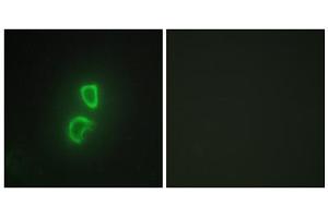 Immunofluorescence analysis of HepG2 cells, using TNF11 antibody. (RANKL 抗体  (Internal Region))