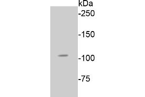 Lane 1: A549 lysates probed with Rb(S807) (2D10) Monoclonal Antibody  at 1:1000 overnight at 4˚C. (Retinoblastoma 1 抗体  (pSer807))