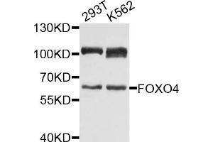 Western blot analysis of extracts of various cell lines, using FOXO4 antibody (ABIN1872735) at 1:1000 dilution. (FOXO4 抗体)