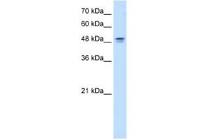 DHODH antibody used at 0. (DHODH 抗体  (N-Term))