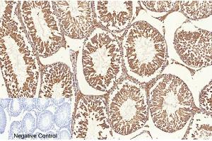 Immunohistochemical analysis of paraffin-embedded rat testis tissue. (NF-kB p65 抗体  (acLys310))