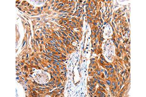 Immunohistochemistry (IHC) image for anti-G Protein-Coupled Receptor Kinase 1 (GRK1) antibody (ABIN1872898) (GRK1 抗体)