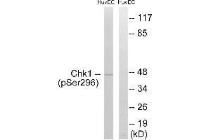 Western blot analysis of extracts from HUVEC cells, treated with UV (15 mins), using Chk1 (Phospho-Ser296) antibody. (CHEK1 抗体  (pSer296))