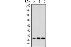 Western blot analysis of CDK6 expression in Hela (A), Jurkat (B), K562 (C) whole cell lysates. (CDK6 抗体)