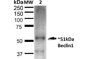 Western blot analysis of Rat Liver showing detection of ~51 kDa Beclin 1 protein using Rabbit Anti-Beclin 1 Polyclonal Antibody (ABIN2868749). (Beclin 1 抗体  (APC))