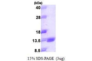 S100A14 Protein (AA 1-104) (His tag)