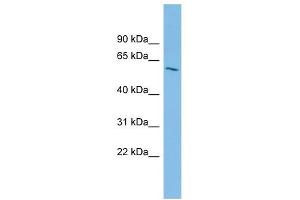 IPPK antibody used at 1 ug/ml to detect target protein. (IPPK 抗体  (Middle Region))