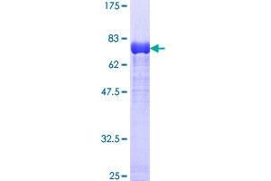 Dynamitin Protein (AA 1-401) (GST tag)