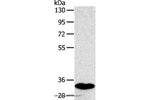 Western blot analysis of Human fetal intestines tissue, using SULT1B1 Polyclonal Antibody at dilution of 1:800 (SULT1B1 抗体)