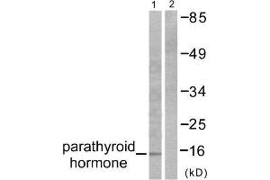 Western Blotting (WB) image for anti-Parathyroid Hormone (PTH) (Internal Region) antibody (ABIN1848724) (PTH 抗体  (Internal Region))