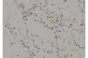 ABIN6274946 at 1/100 staining Human lung tissue by IHC-P. (CAGE1 抗体  (C-Term))