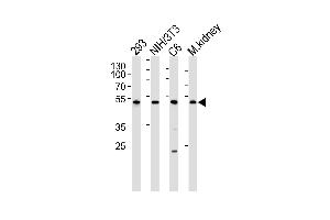 Western blot analysis of lysates from 293, mouse NIH/3T3, rat C6 cell line and mouse kidney tissue lysate(from left to right), using Mouse Cdk9 Antibody at 1:1000 at each lane. (CDK9 抗体  (C-Term))