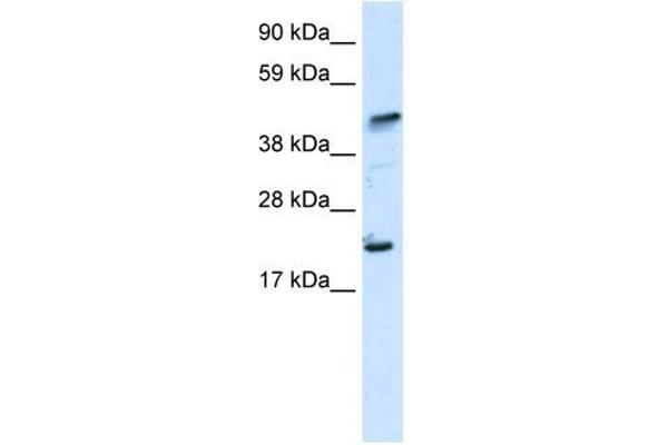 IKZF5 抗体  (N-Term)