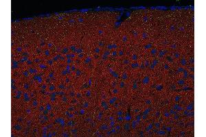 Indirect immunostaining of PFA fixed paraffin embedded mouse cortex section with anti-Homer 1/2/3 (dilution 1 : 500; red) and mouse anti-SERT (green). (Homer 1/2/3 (N-Term) 抗体)