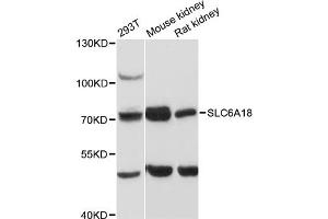 Western blot analysis of extracts of various cell lines, using SLC6A18 antibody (ABIN6290962) at 1:3000 dilution. (SLC6A18 抗体)