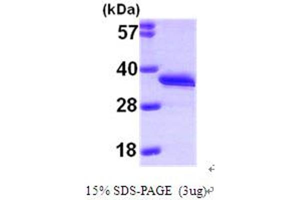 DCK Protein (AA 1-260) (His tag)