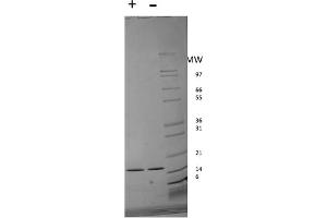 SDS-PAGE of Human Interferon-alpha 2b Recombinant Protein SDS-PAGE of Human Interferon-alpha 2B Recombinant Protein. (IFNA2 蛋白)