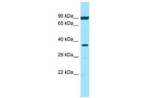 Host: Rabbit  Target Name: NFKBIA  Sample Tissue: Hela Whole Cell lysates  Antibody Dilution: 1. (NFKBIA 抗体  (N-Term))