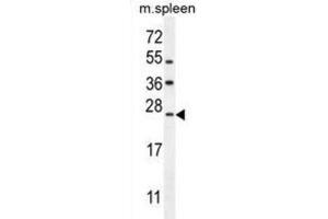 Western Blotting (WB) image for anti-LIM Domain Only 4 (LMO4) antibody (ABIN2995822) (LMO4 抗体)