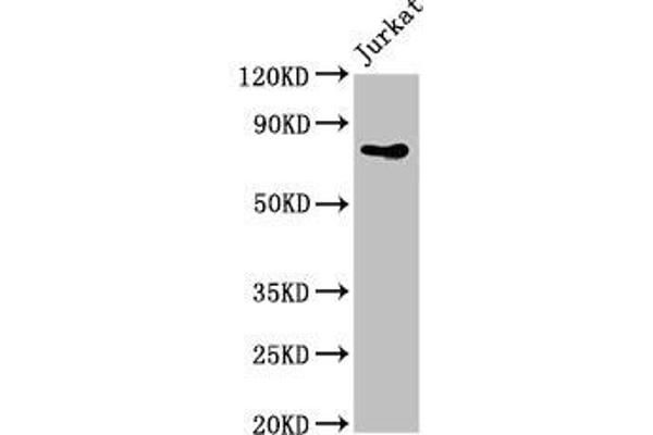 PIK3R2 抗体  (Regulatory Subunit beta)