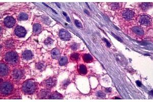 Anti-PDK1 antibody IHC staining of human testis, spermatogonia. (PDPK1 抗体)