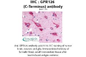 Image no. 1 for anti-G Protein-Coupled Receptor 126 (GPR126) (C-Term) antibody (ABIN1734923) (G Protein-Coupled Receptor 126 抗体  (C-Term))